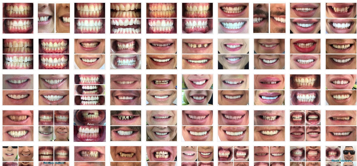 Smile transformation collection